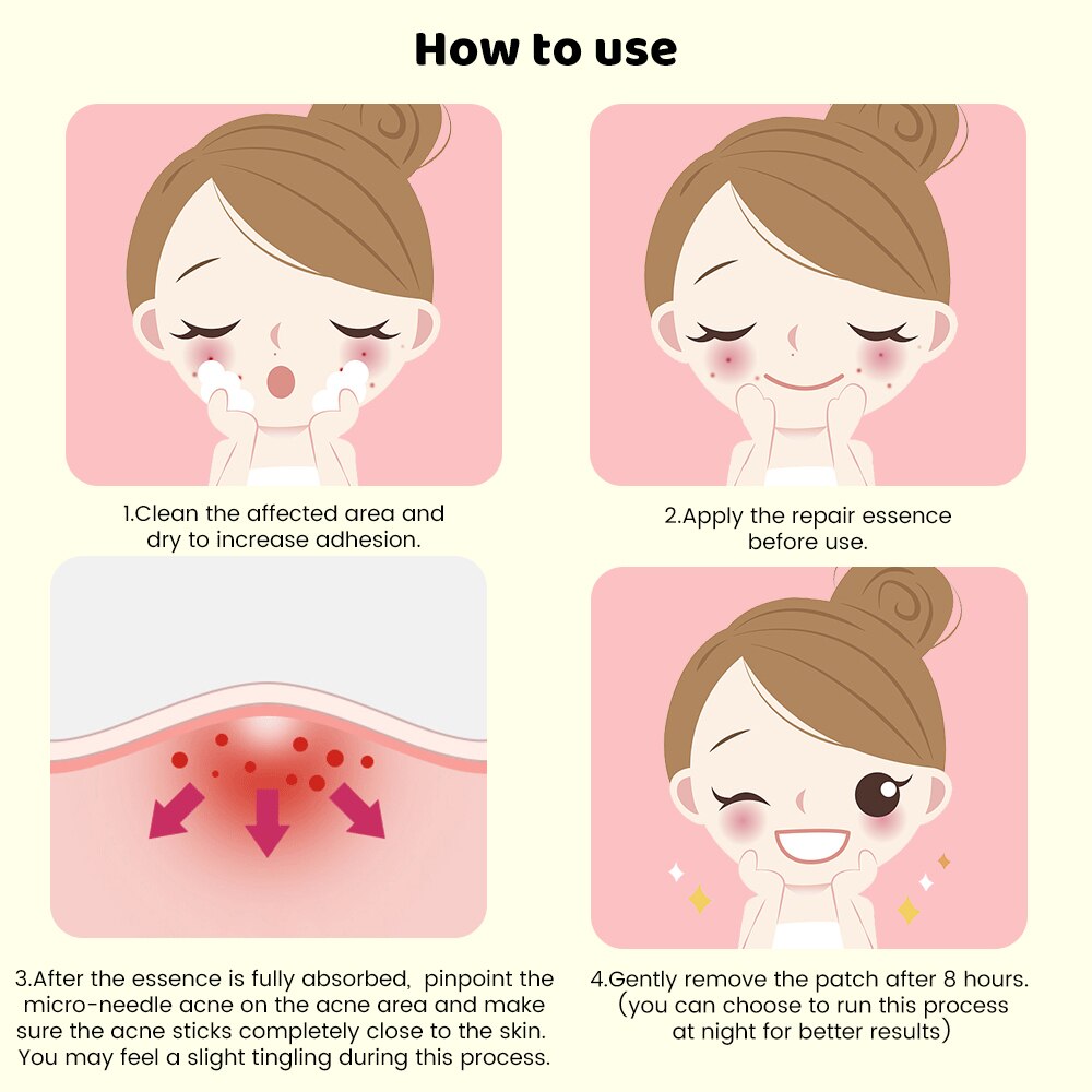 9pcs Translucent Microneedle